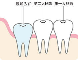 正常なタイプ